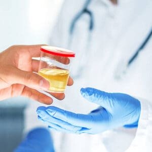 Urine Culture & Sensitivity Test