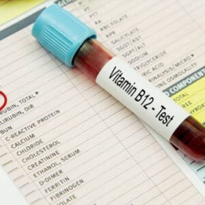 Vitamin B12 Serum Test