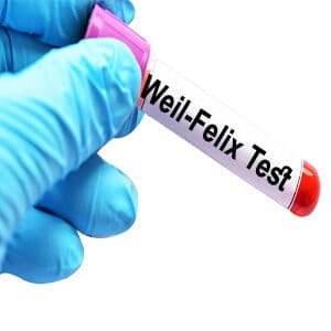 Weil Felix Test