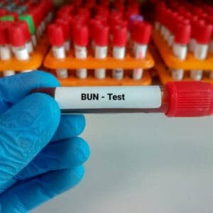 Blood Urea Test