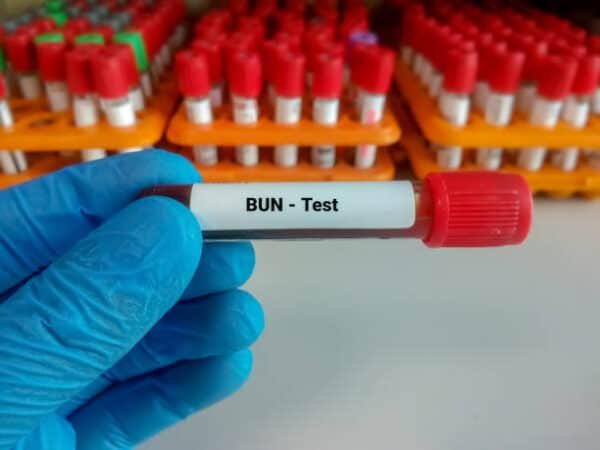 Blood Urea Test