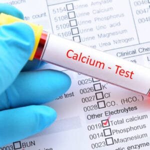 Calcium Serum Test