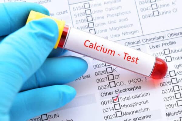 Calcium Serum Test