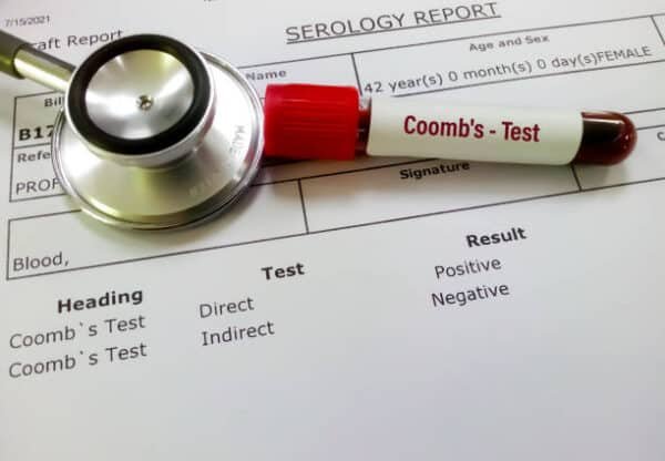 Coombs DCT Test