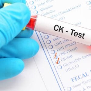 creatine kinase test