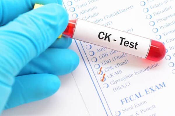 creatine kinase test