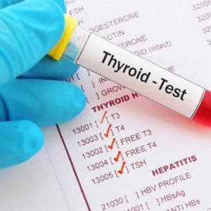 thyroid peroxidase antibody test