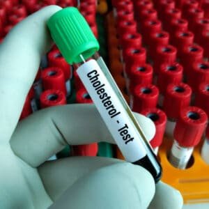 total cholesterol test