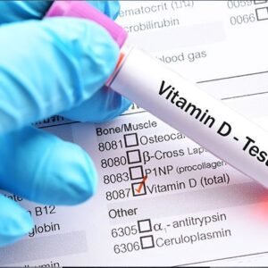 Vitamin D Test