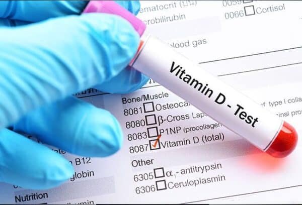 Vitamin D Test